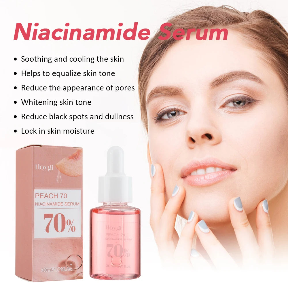 Niacinamide Dark Spot Remover – Fade Pigmentation, Moisturize & Tighten Pores for Radiant Skin  30ML