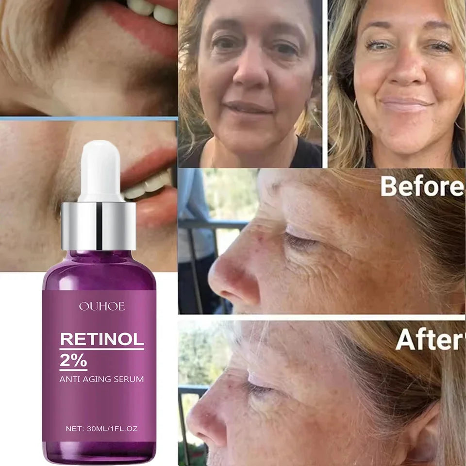GlowRenew Retinol Serum – Wrinkle Repair & Whitening Complex