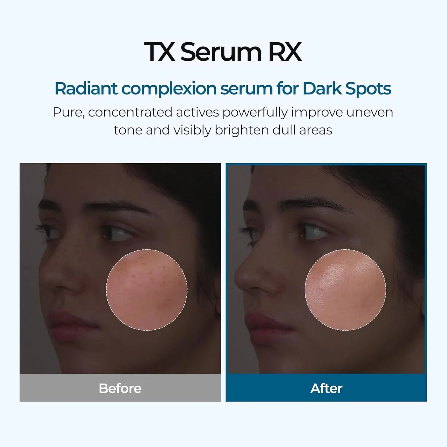 Dr. Melaxin Facial Treatment Ampoules | Niacinamide, Whitening & Scar Fading Care