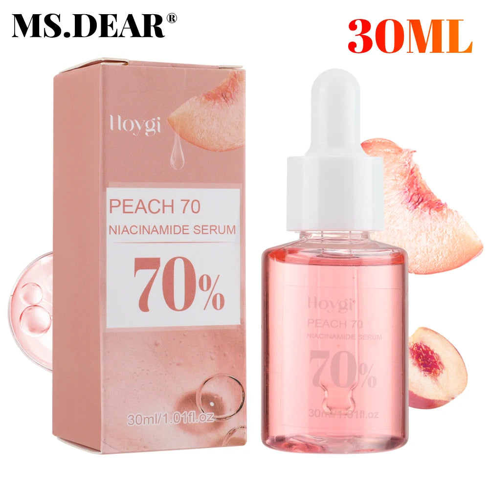 Niacinamide Dark Spot Remover – Fade Pigmentation, Moisturize & Tighten Pores for Radiant Skin  30ML