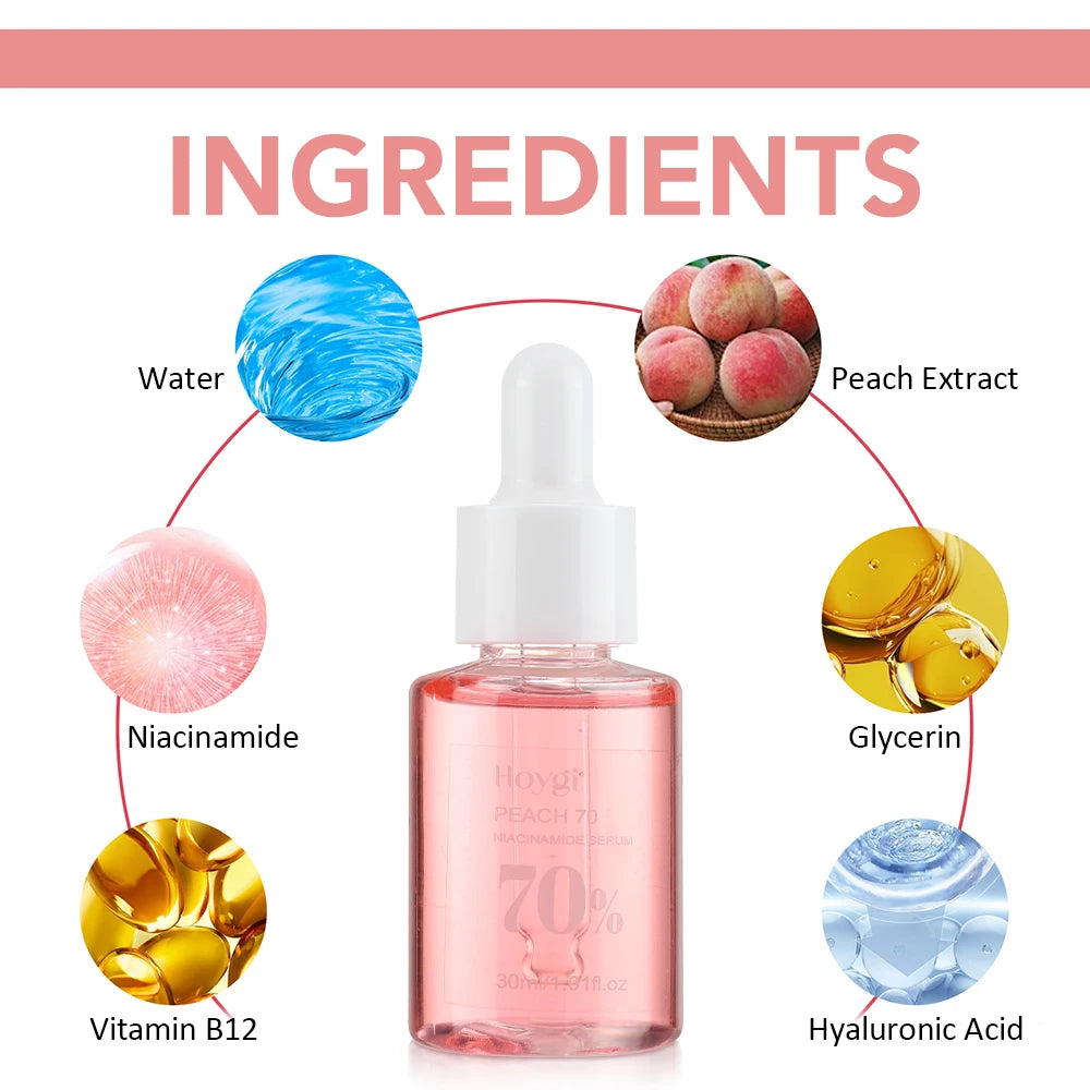 Niacinamide Dark Spot Remover – Fade Pigmentation, Moisturize & Tighten Pores for Radiant Skin  30ML