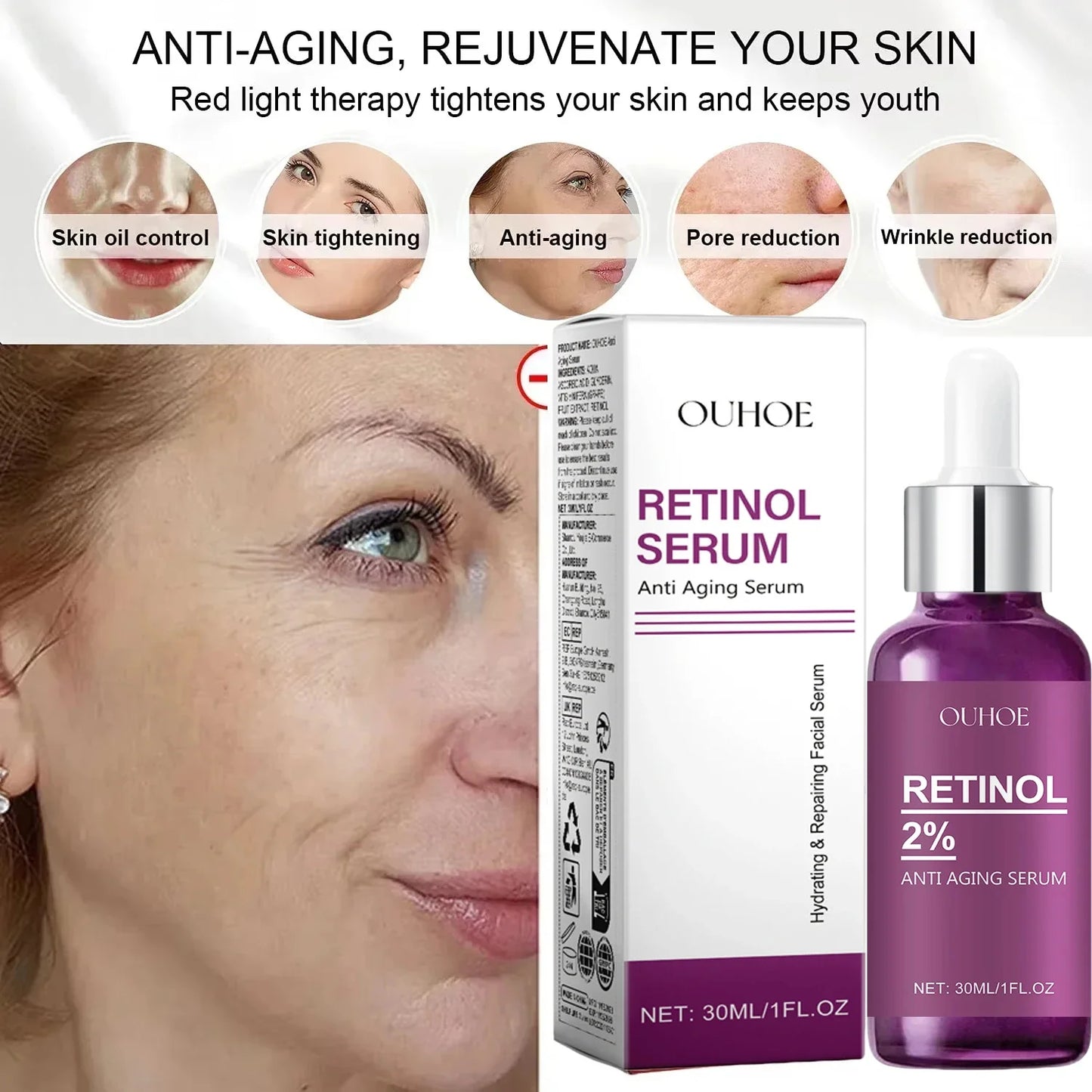 GlowRenew Retinol Serum – Wrinkle Repair & Whitening Complex