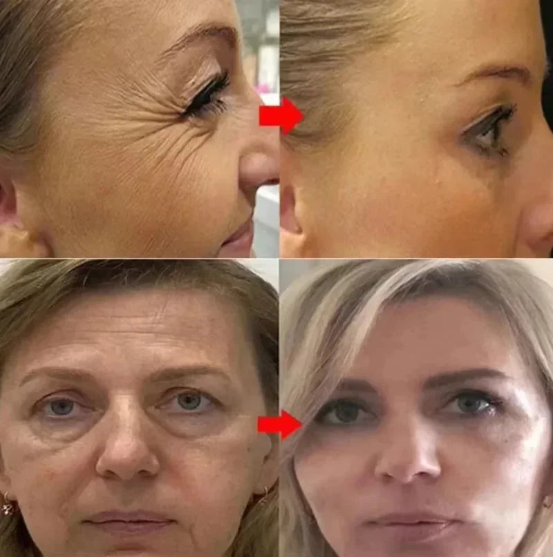 GlowRenew Retinol Serum – Wrinkle Repair & Whitening Complex