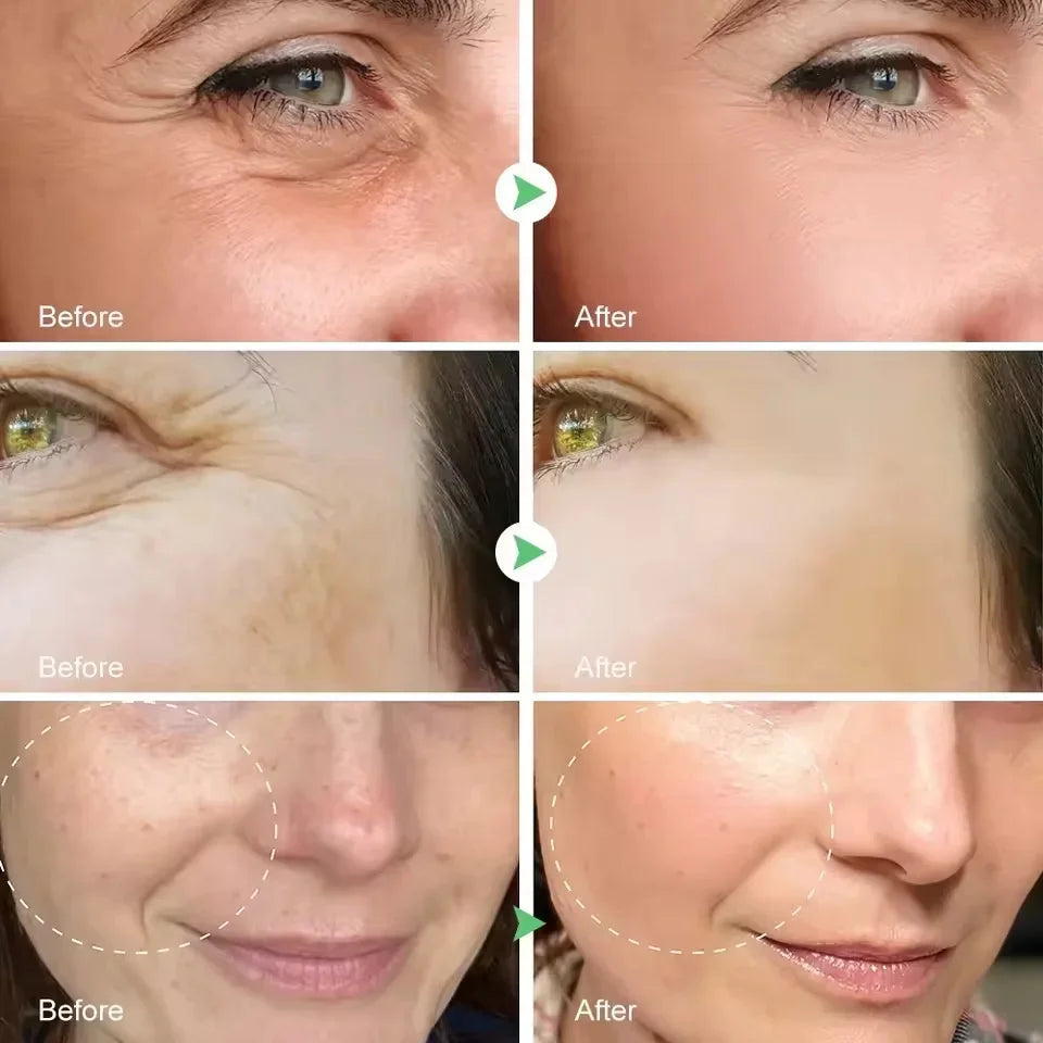 GlowRenew Retinol Serum – Wrinkle Repair & Whitening Complex