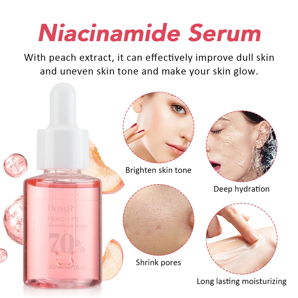 Niacinamide Dark Spot Remover – Fade Pigmentation, Moisturize & Tighten Pores for Radiant Skin  30ML