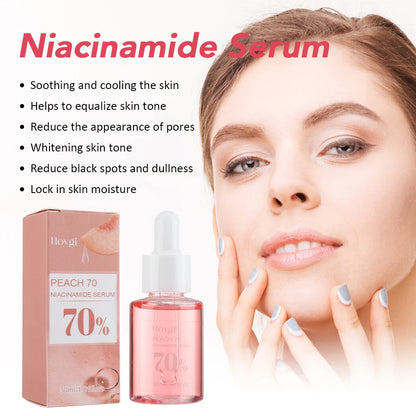 Niacinamide Dark Spot Remover – Fade Pigmentation, Moisturize & Tighten Pores for Radiant Skin  30ML