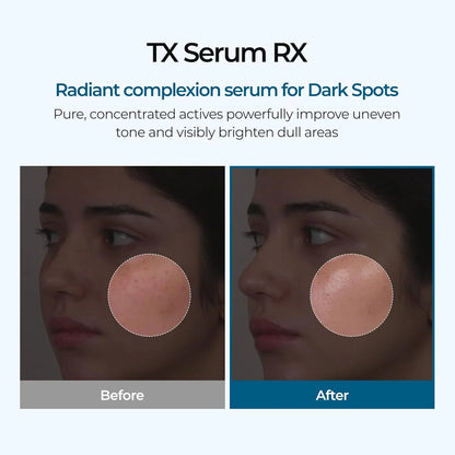 Dr. Melaxin Facial Treatment Ampoules | Niacinamide, Whitening & Scar Fading Care