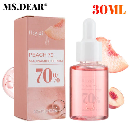 Niacinamide Dark Spot Remover – Fade Pigmentation, Moisturize & Tighten Pores for Radiant Skin  30ML