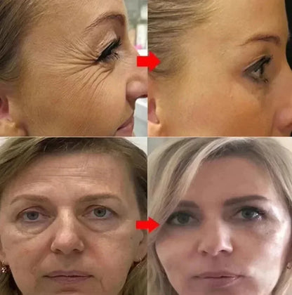 GlowRenew Retinol Serum – Wrinkle Repair & Whitening Complex